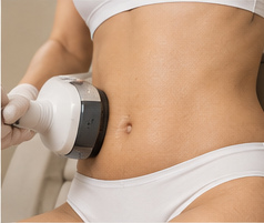 RF Microneedling Including Morpheus8