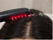 HydraScalp