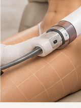 Ultherapy body rejuvenation
