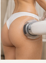 Microneedling and skin remodeling
