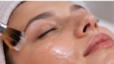 Chemical Peels treatment