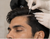 Hair Loss and Restoration for Men