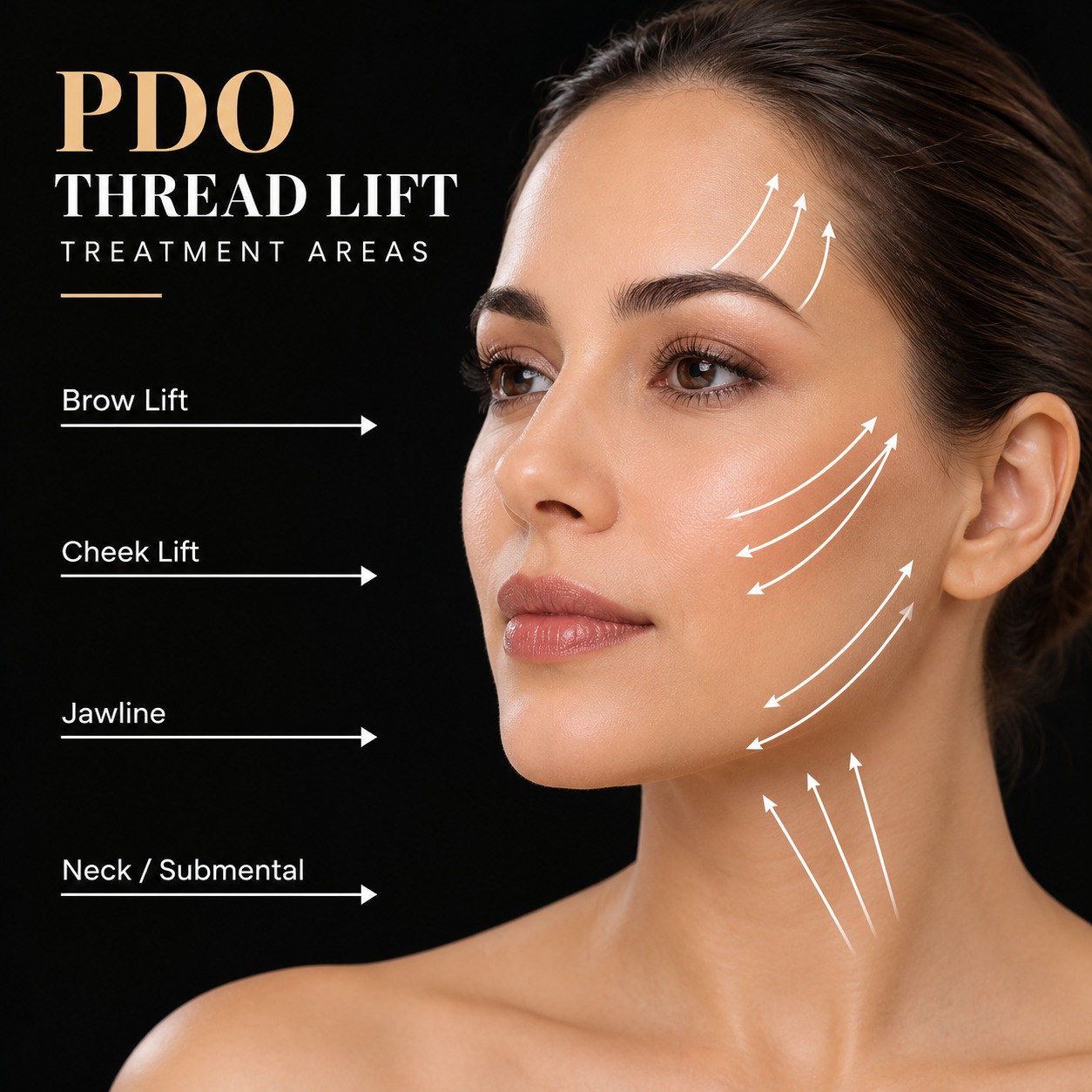 PDO thread treatment