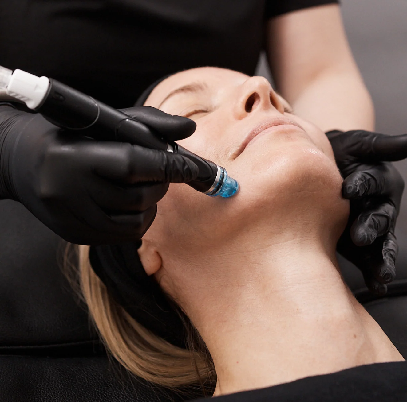 HydraFacial treatment