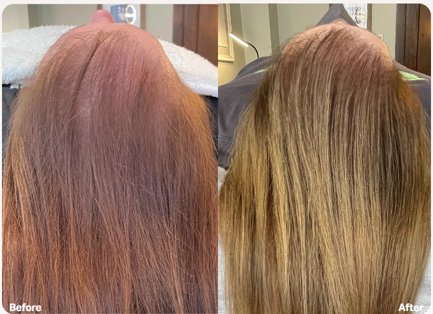 HydraScalp before and after result