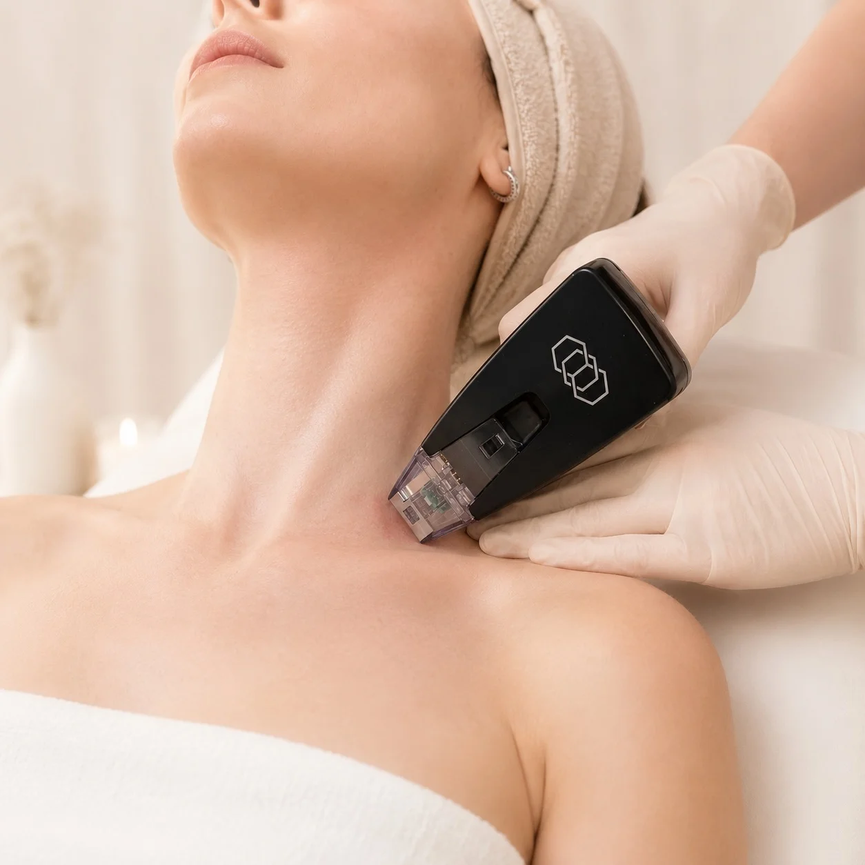 Microneedling and RF Microneedling treatment