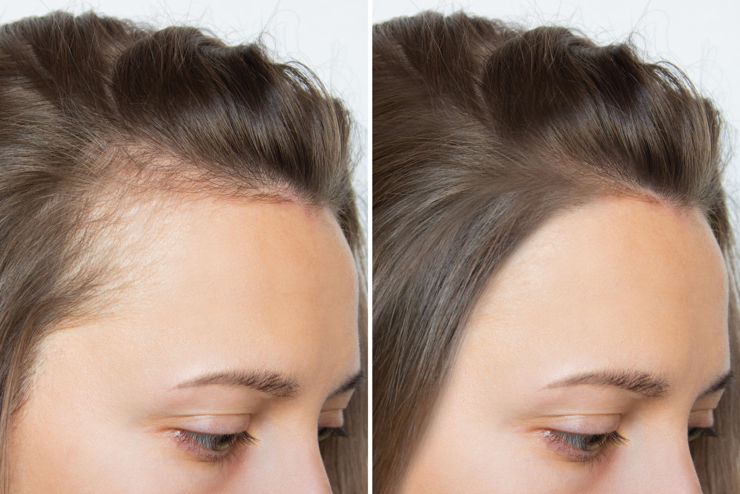 Hair treatment